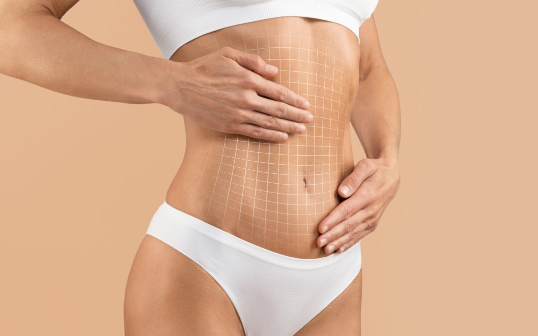 Abdominoplasty Nagpur