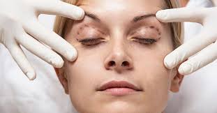 Affordable Cosmetic Surgery Nagpur