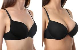 Breast augmentation Nagpur