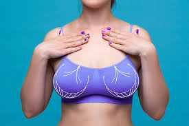 Breast lift surgery Nagpur