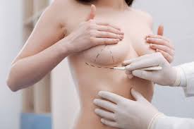 Breast reconstruction Nagpur