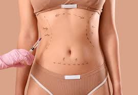 Cosmetic body surgery Nagpur