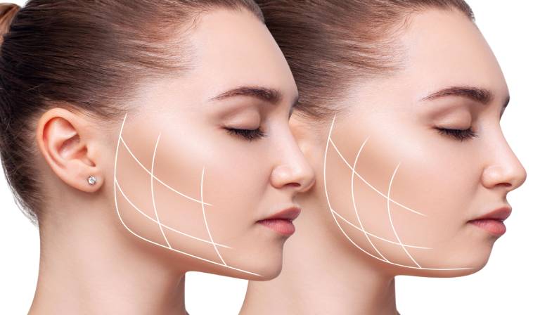 Jawline surgery Nagpur