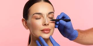 Rhinoplasty in Nagpur