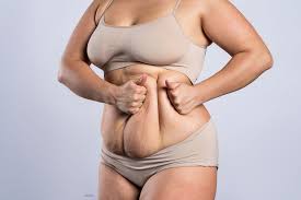 Weight loss surgery cosmetic Nagpur